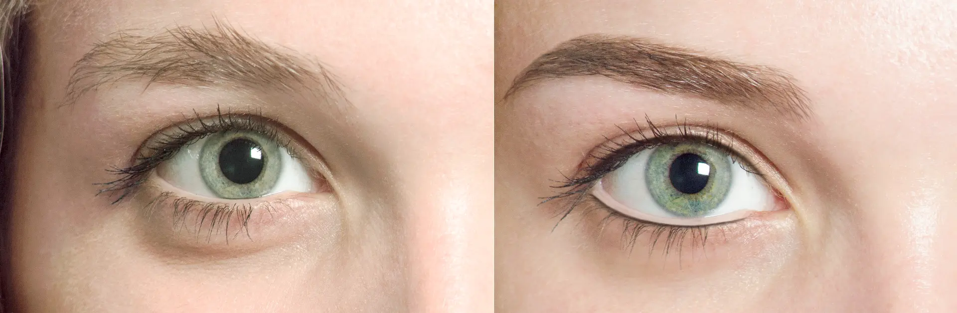 Auge im Vergleich, links vorher, rechts nachher