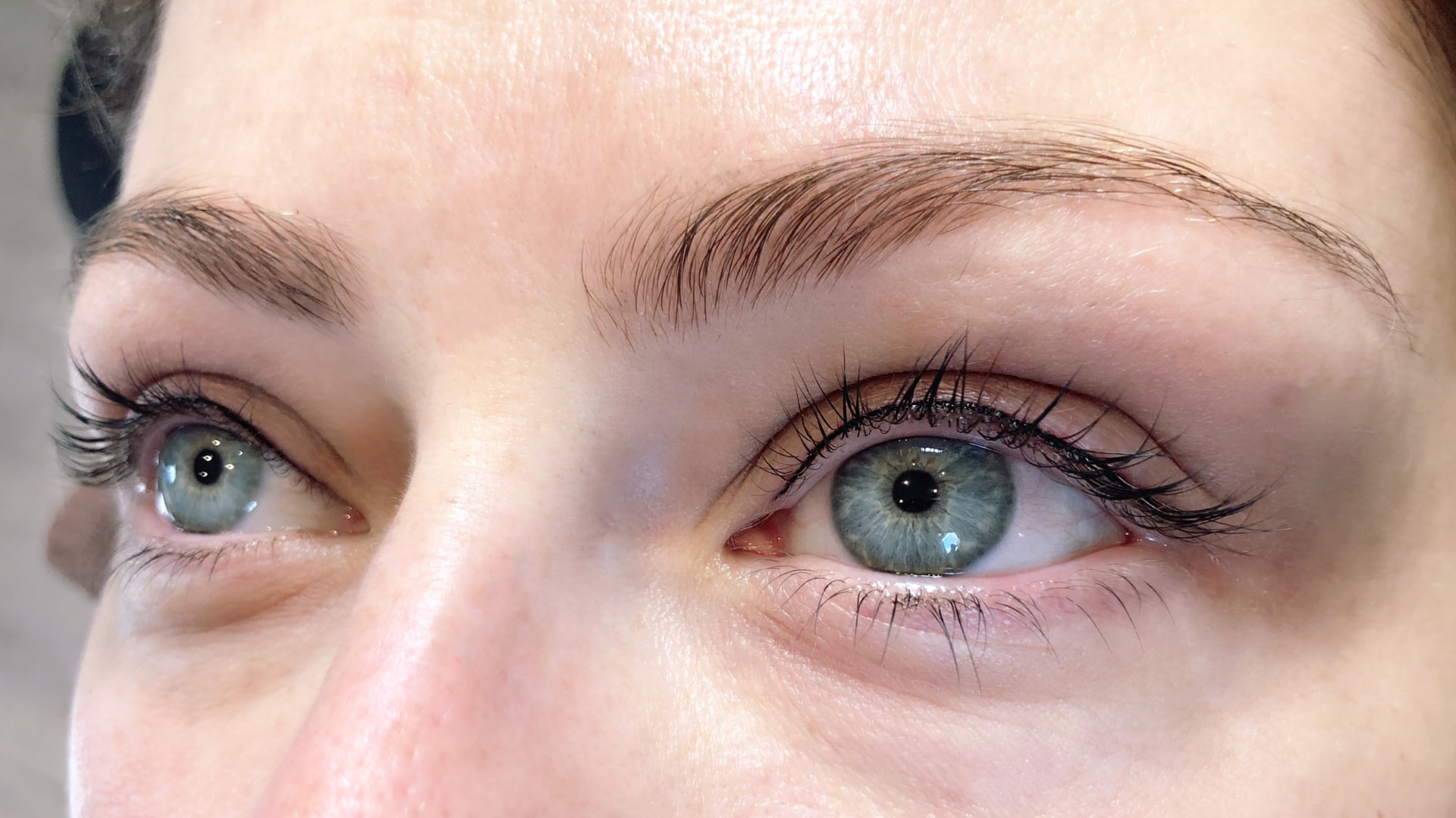 Wimpernkranz, beide Augen